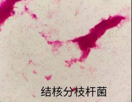 结核分枝杆菌的生物学特性、培养方法及应用