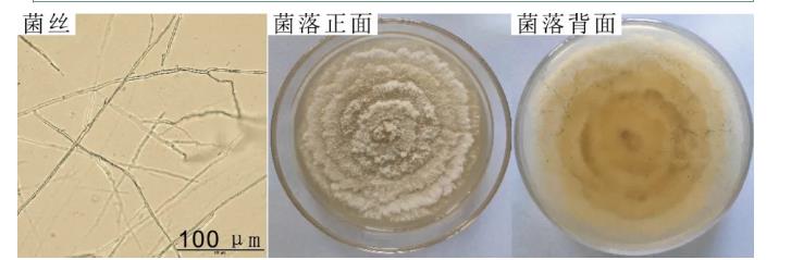 柑桔砂皮病菌座壳菌生长条件及纳米药剂筛选（一）