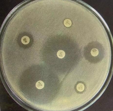 抗生素的作用机制及药敏试验方法